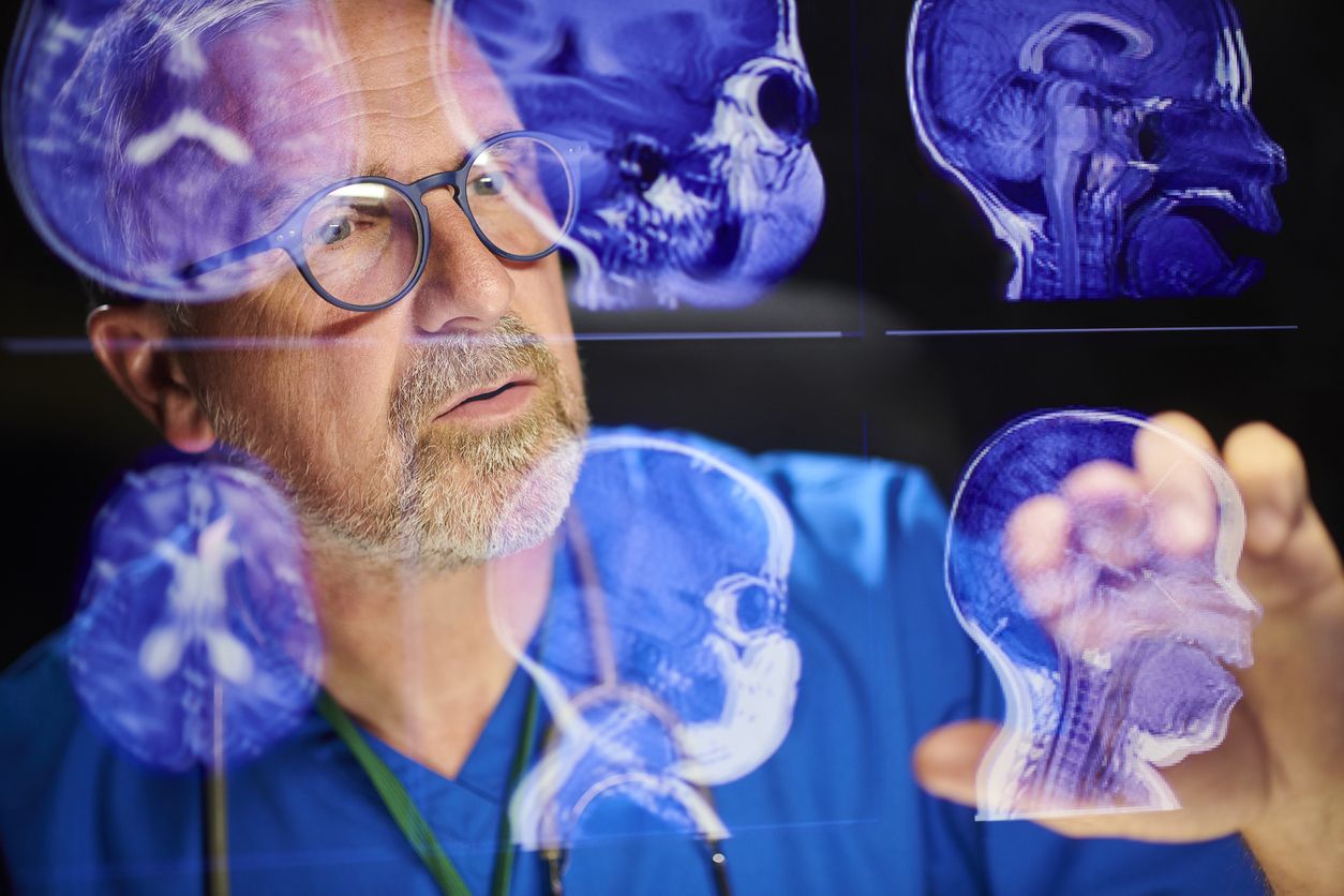 doctor looking at brain scans